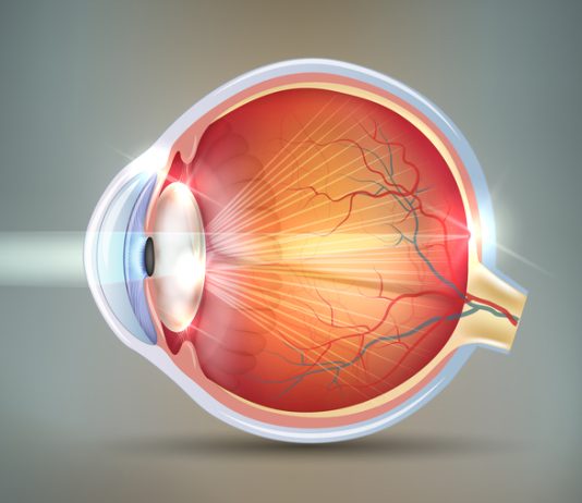 THE EYE CONDITION OF HAVING CATARACTS Cataracts abstract grey background